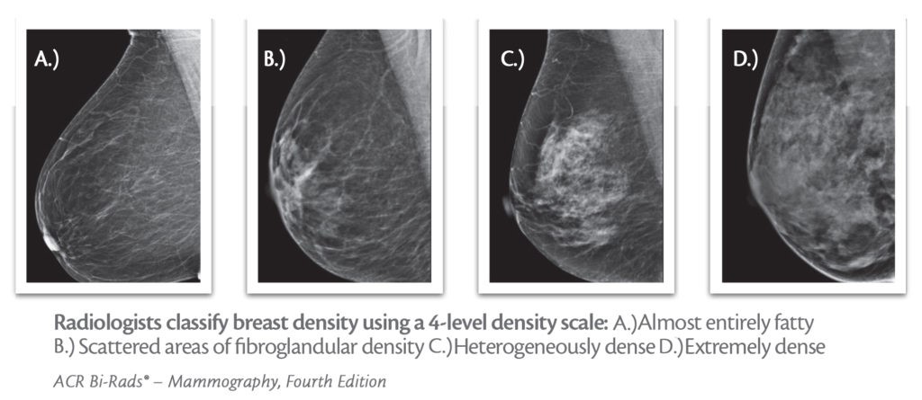 Breast Density Samples